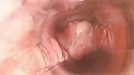 ឆ្កេពីរនាក់ត្រូវបាន fucked នៅក្នុង gangbang និងព្យាបាលជាមួយ cum។